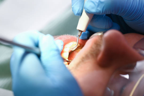 Best Cracked Tooth Emergency Dentist  in Clear Lake, WI