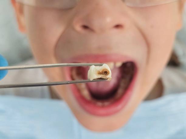Best Emergency Dentist for Kids  in Clear Lake, WI